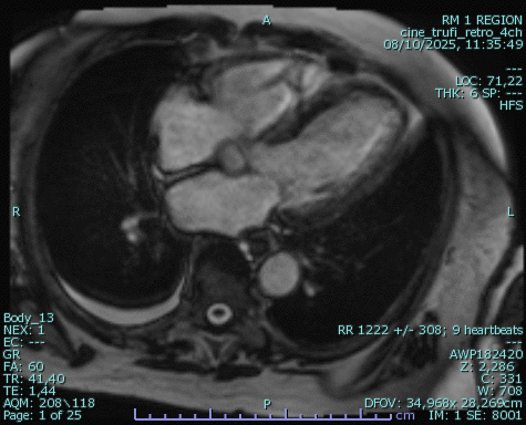 Estudios Cardíacos de Imagen